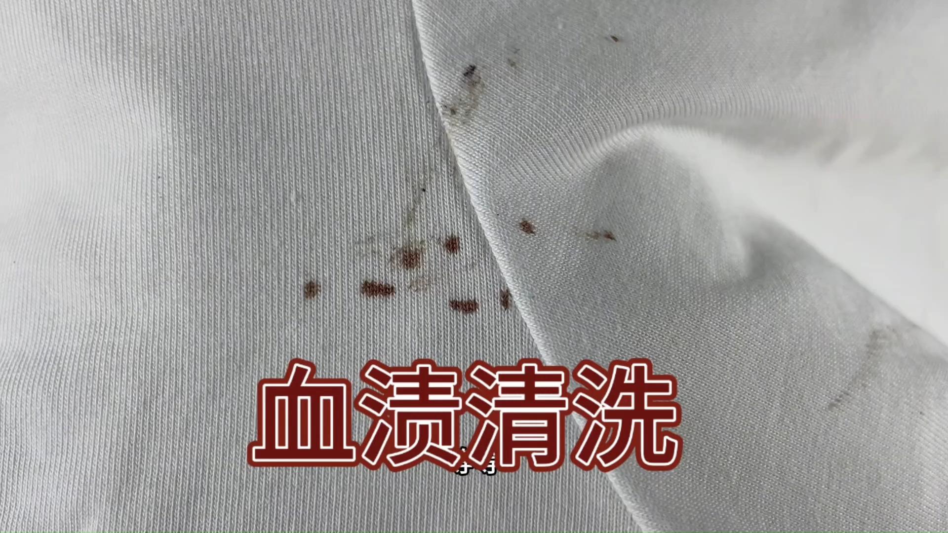 衣服上的血渍怎么洗
