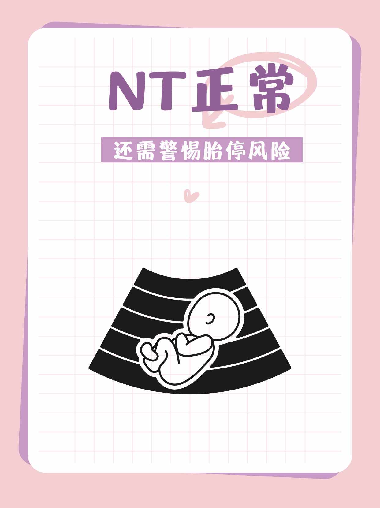 先兆流产保胎成功标志